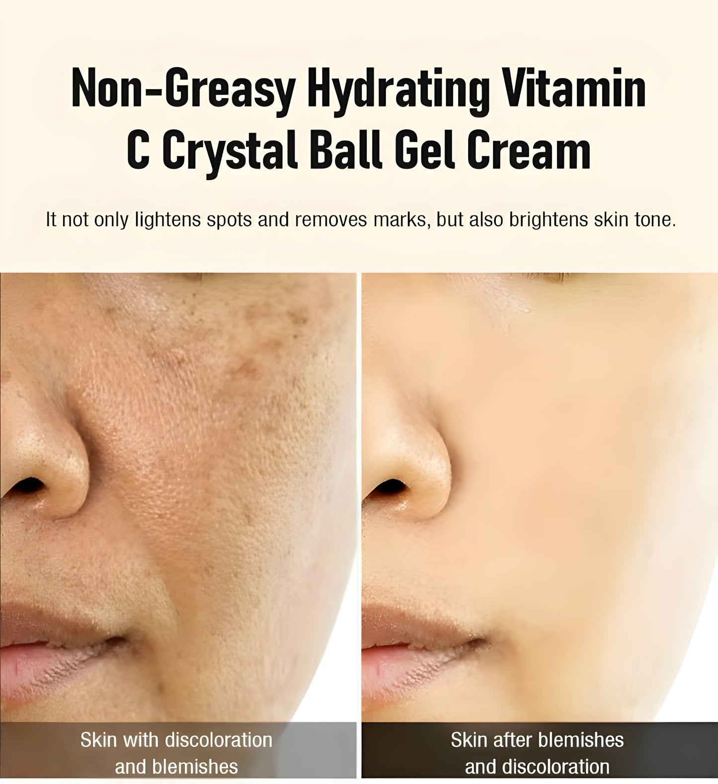 Exnotic—Gel With Vitamin C Capsule Cream