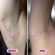 Electric Smooth Shaver - Awaken your confidence with every shave