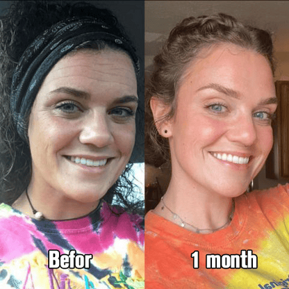 SCAR SOLUTIONS - Silicone Scar Stick - For Face and Body