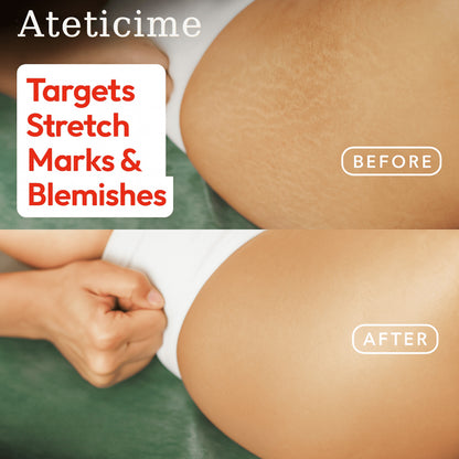 Ateticime Magic Body Oil