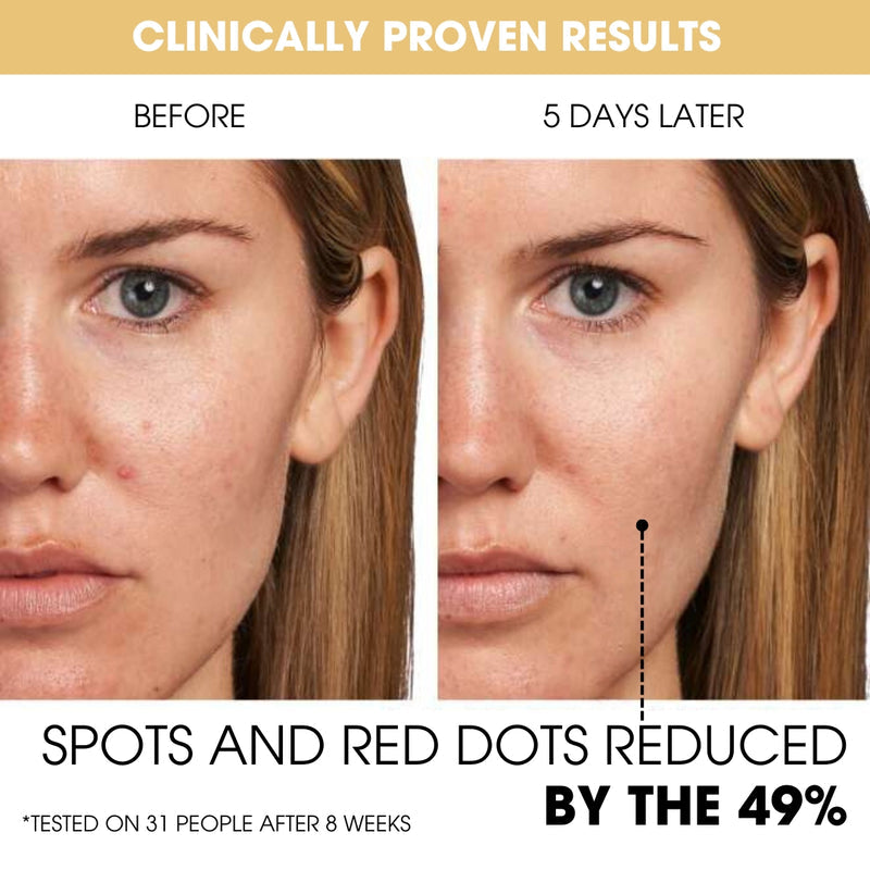 Exnotic—Gel With Vitamin C Capsule Cream