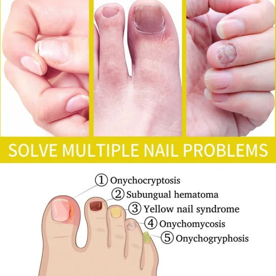 Nail Growth AndStrengthening Serum