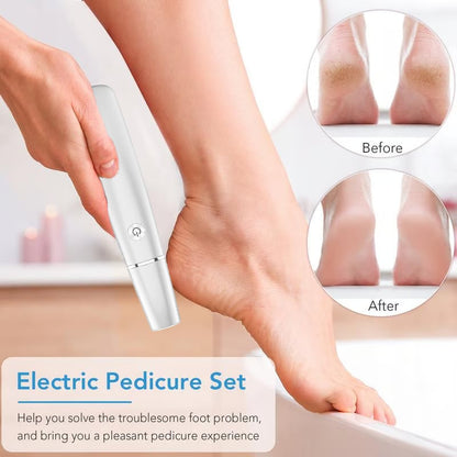 Last Day 49% OFF！Electric Feet Callus Remover