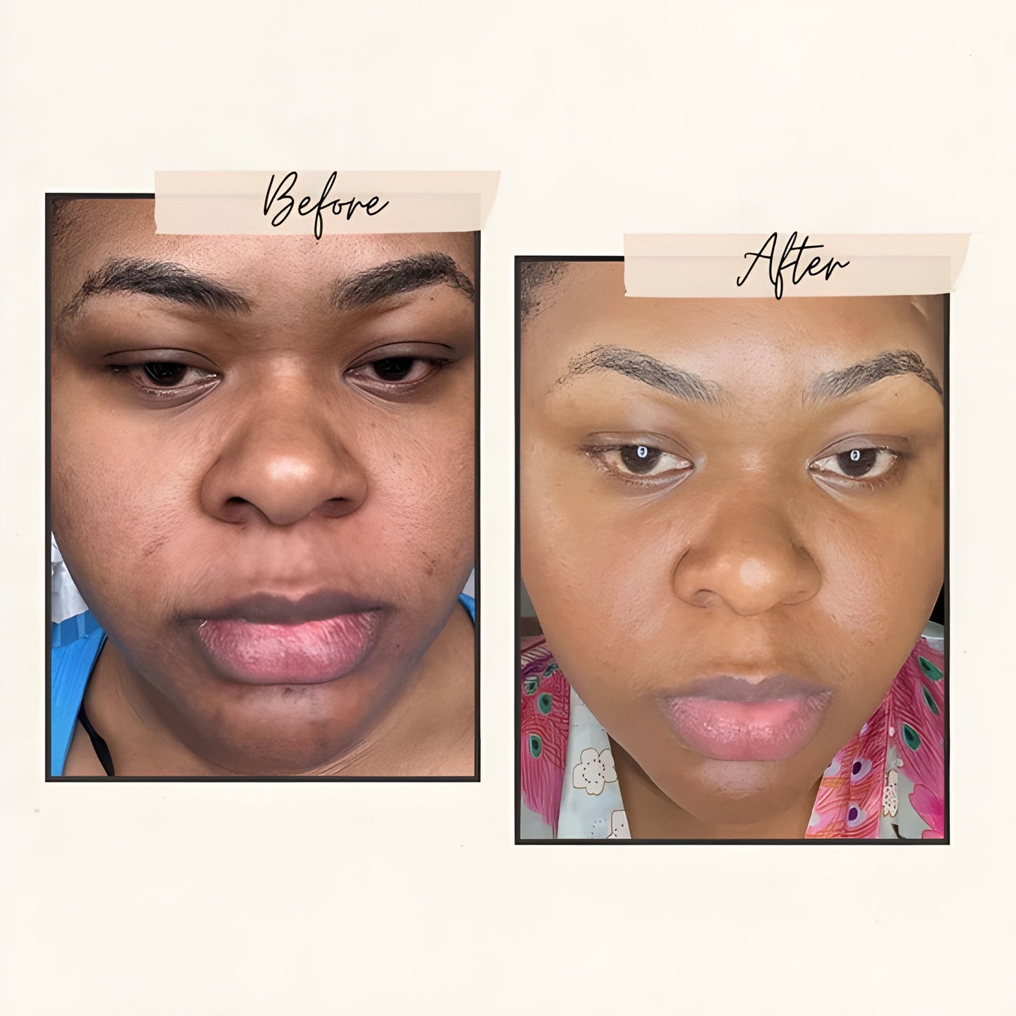 Exnotic—Gel With Vitamin C Capsule Cream