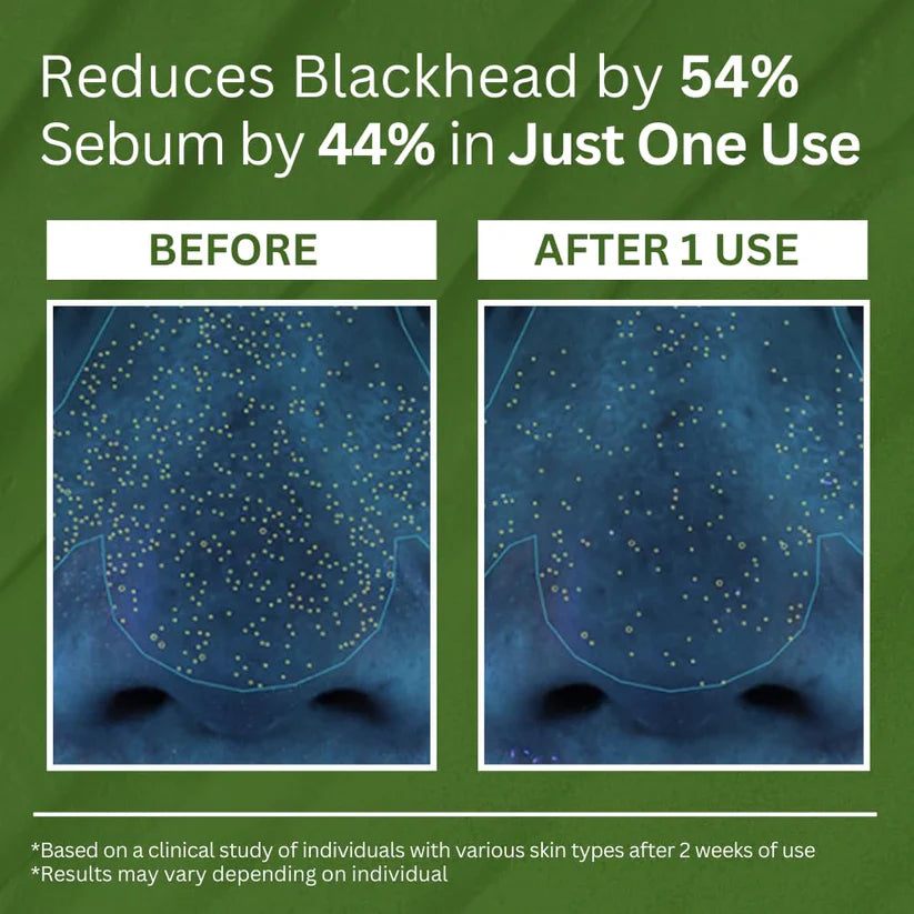 Smooth, Radiant Skin – Activated by Holy Basil & Bubble Detox Action