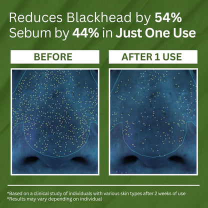 Smooth, Radiant Skin – Activated by Holy Basil & Bubble Detox Action