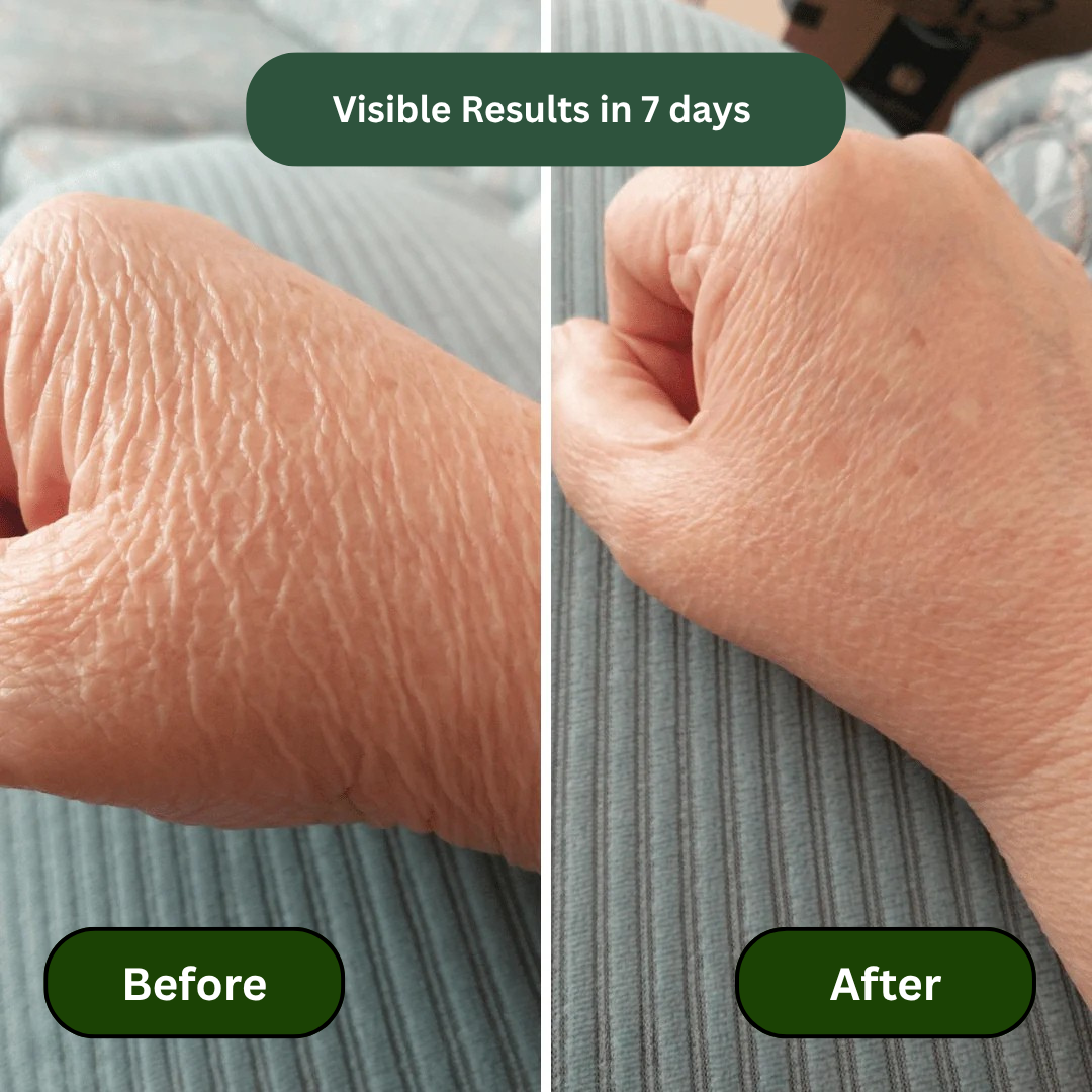 Crepey Skin Repair Treatment