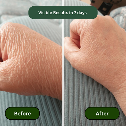 Crepey Skin Repair Treatment