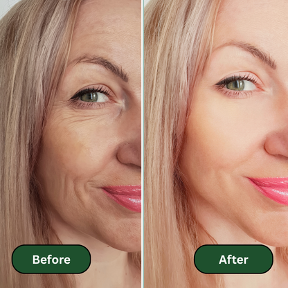 Crepey Skin Repair Treatment