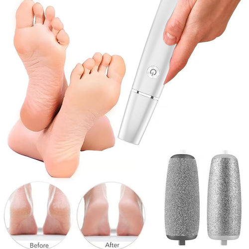 Last Day 49% OFF！Electric Feet Callus Remover