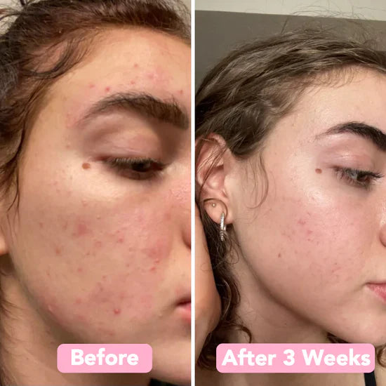 Turmeric Kojic Acid Cleansing Pads