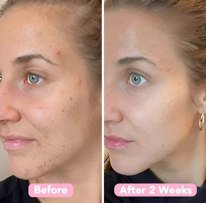 Turmeric Kojic Acid Cleansing Pads