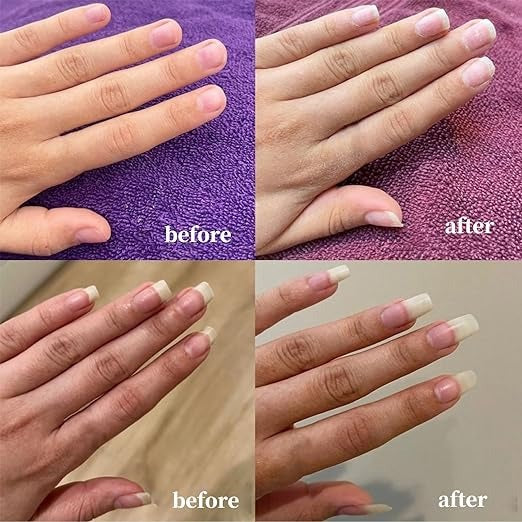Nail Growth AndStrengthening Serum