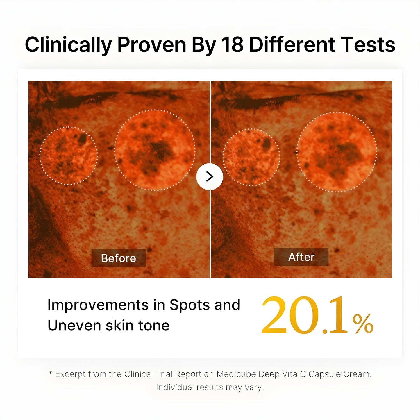 Exnotic—Gel With Vitamin C Capsule Cream