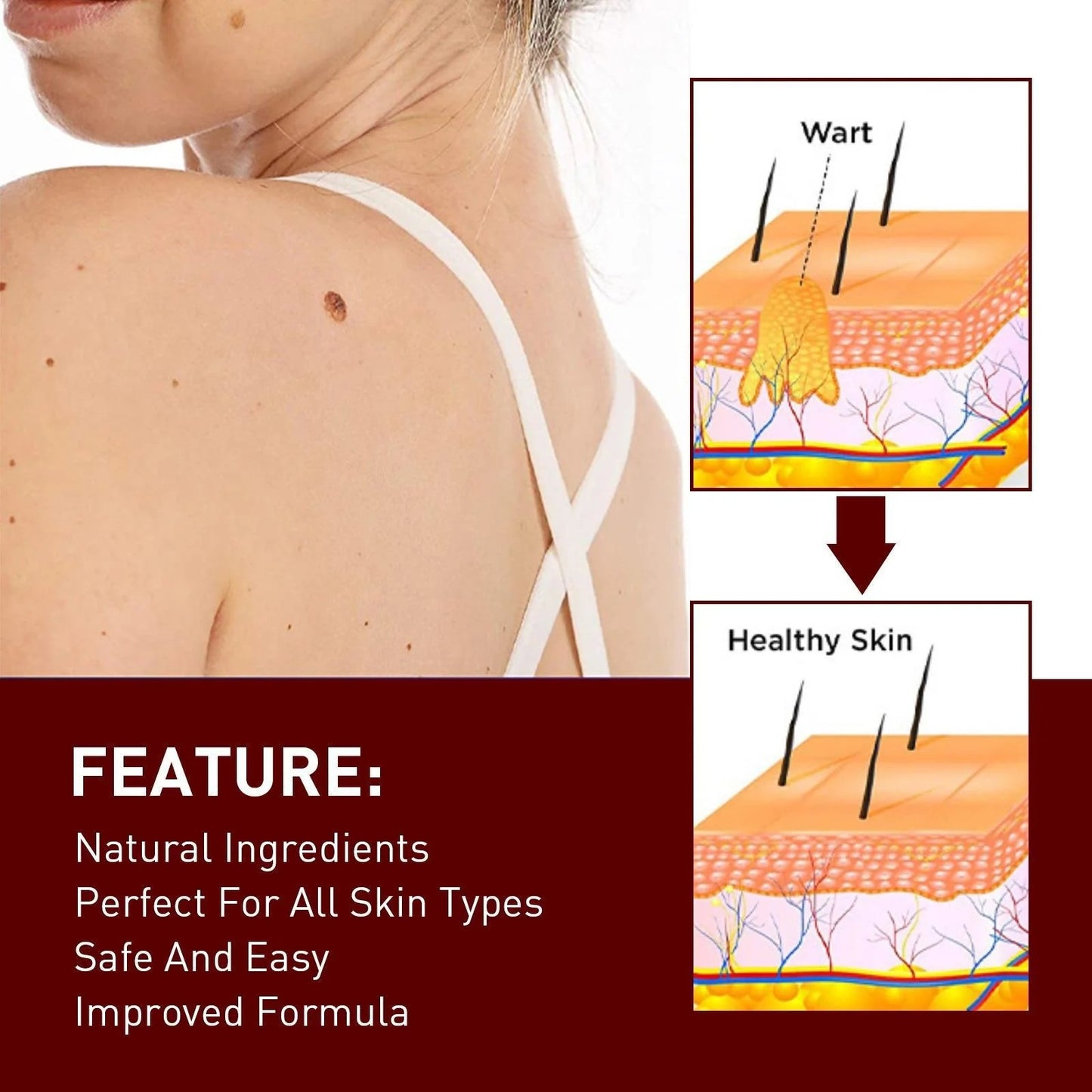 Best Sellers - Tags & Moles Remover——10 pcs (FREE SHIPPING)